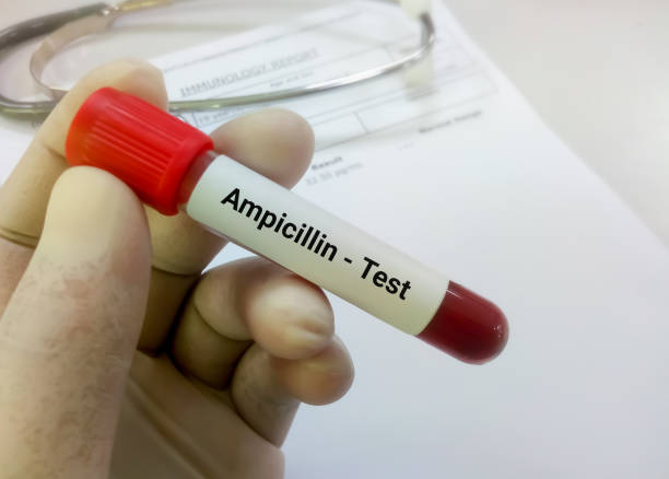 Ống mẫu có nhãn Ampicillin Test được cầm bằng tay đeo găng trong phòng xét nghiệm
