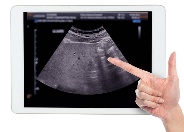 Hình ảnh siêu âm hiển thị trên màn hình phục vụ chẩn đoán thú y